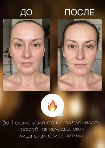 Наверное, вы уже слышали, что в городе появился массажист. Это я.