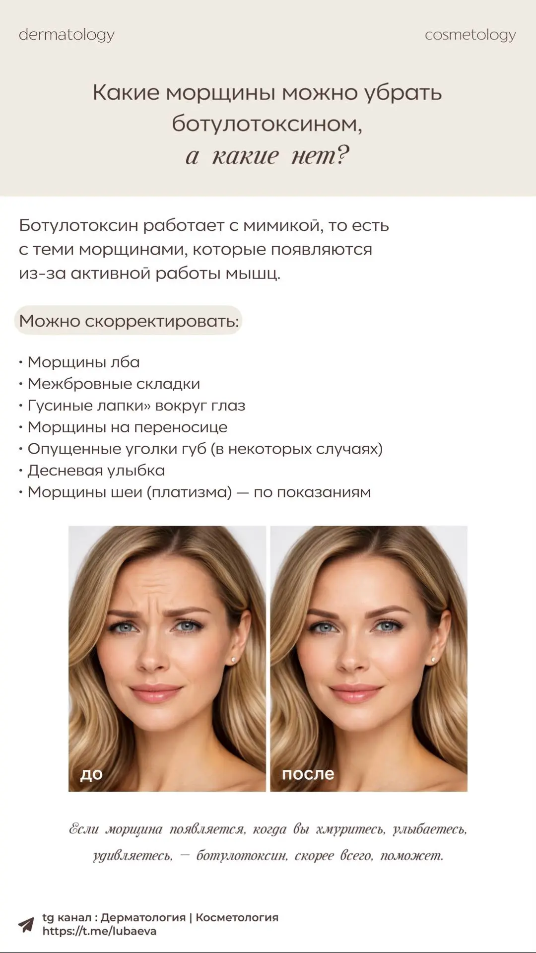 Ботулотоксин — один из самых эффективных инструментов в косметологии, но он работает не...