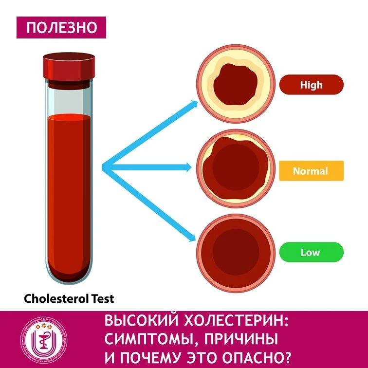 Высокий уровень холестерина. Почему он опасен, как его распознать и что приводит к его ...