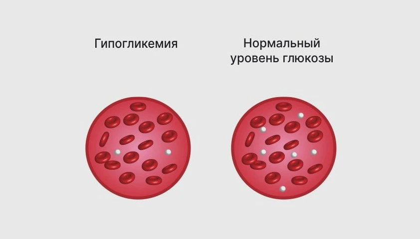 Через пару часов после сладкого обеда вдруг накрывает слабостью, руки трясутся, хочется срочно что-т
