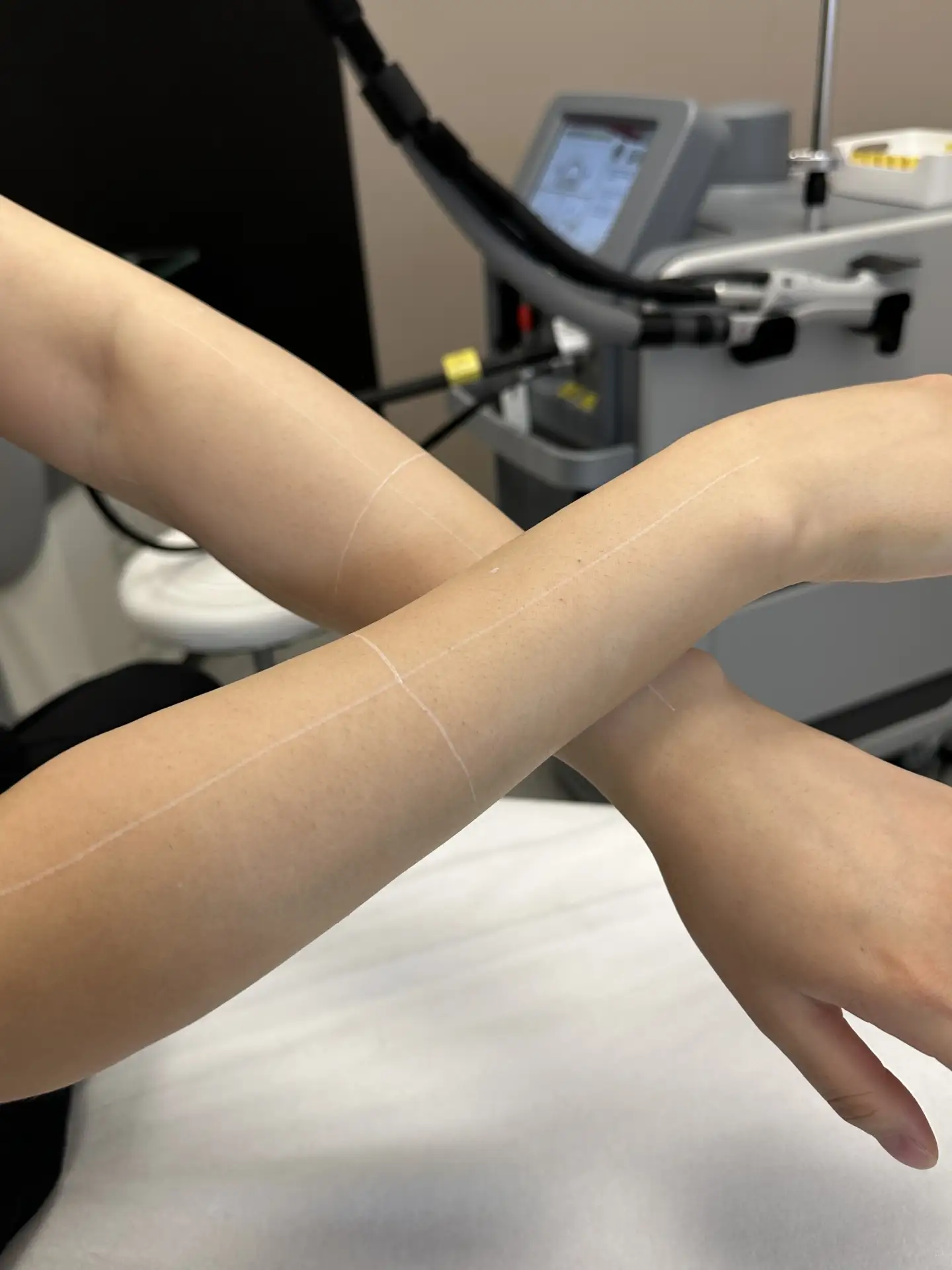 3 вещи, на которые мастер смотрит перед процедурой👩🏻‍⚕️