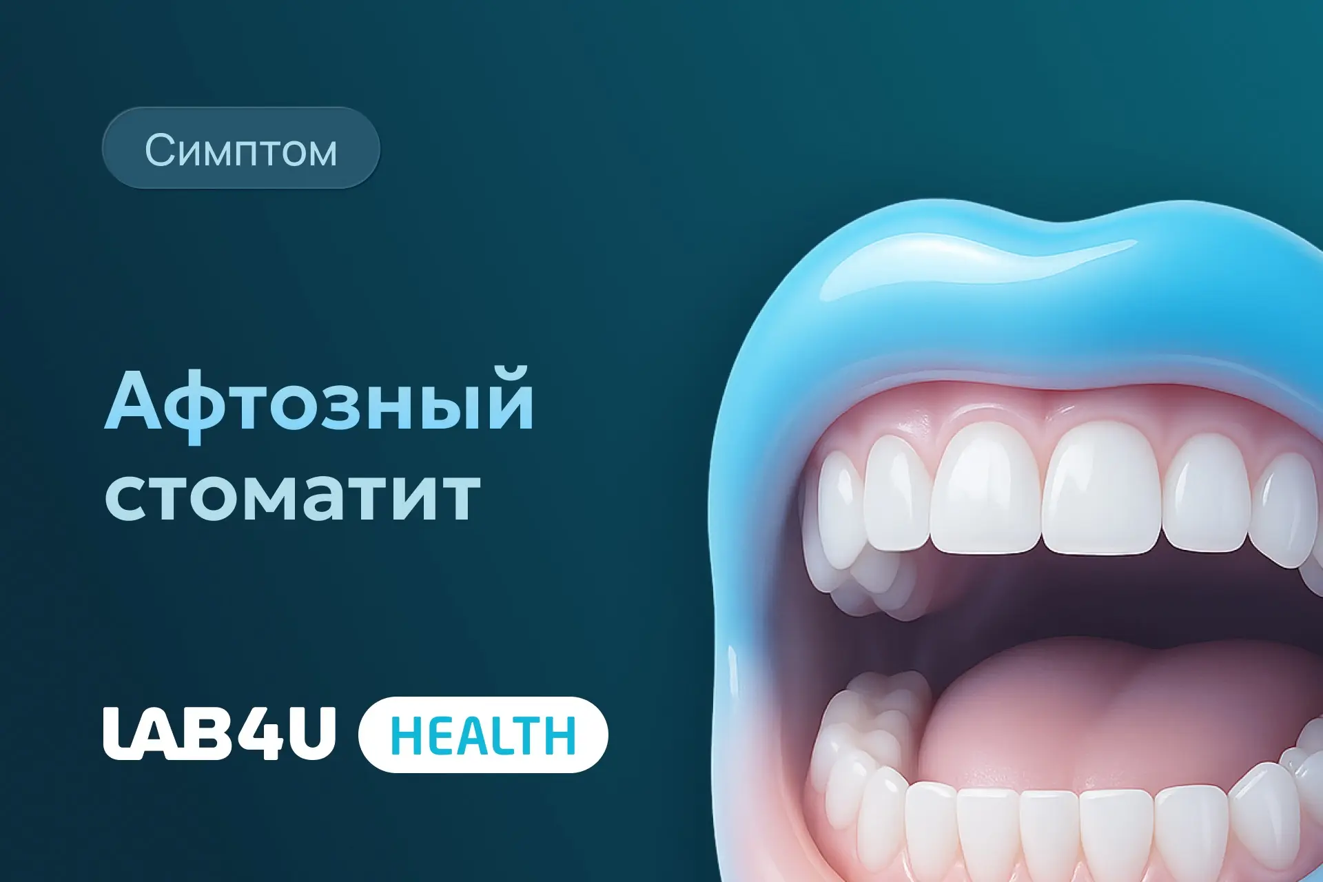 Это заболевание слизистой оболочки полости рта. Проявляется в виде болезненных язв: круглого желтова