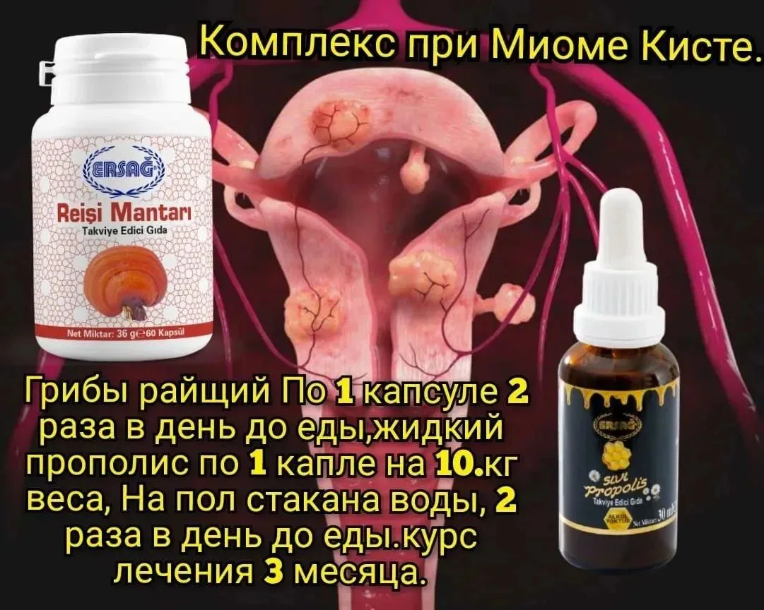#миома , #киста .