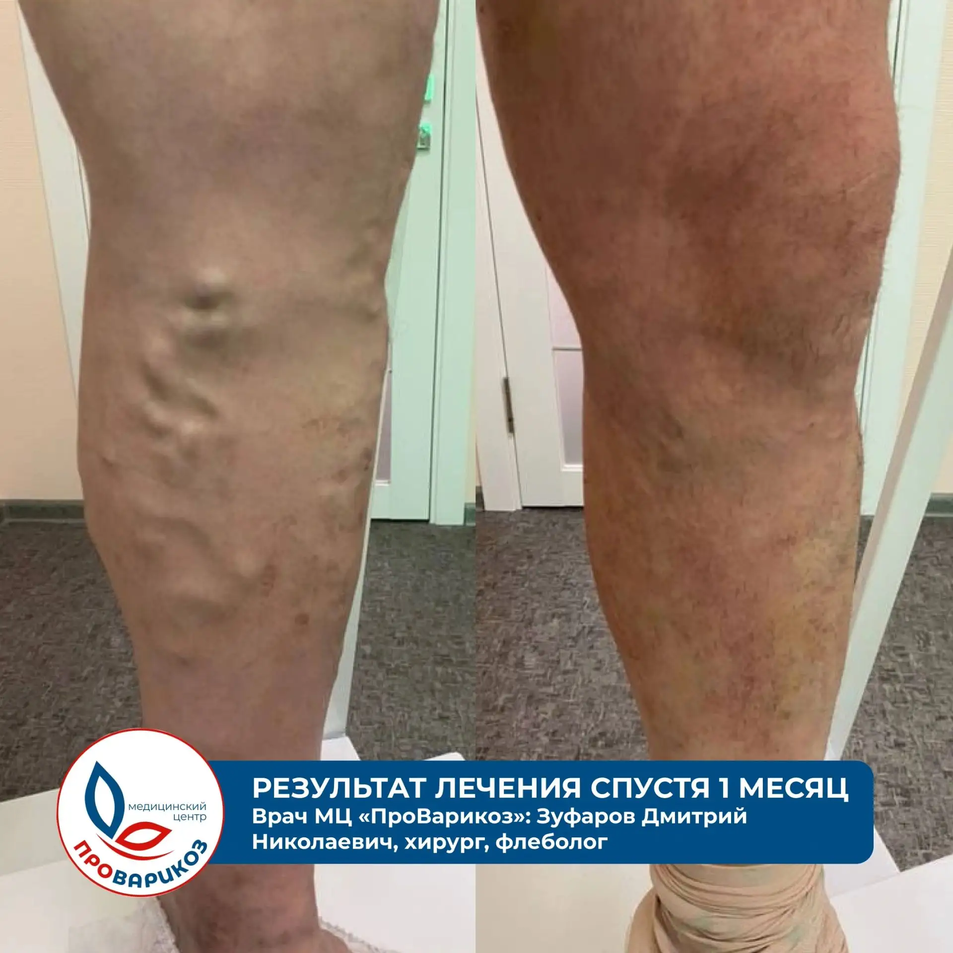 ❗ 28 августа в Камышине состоится выездной приём флеболога из Волгограда. На консультац...