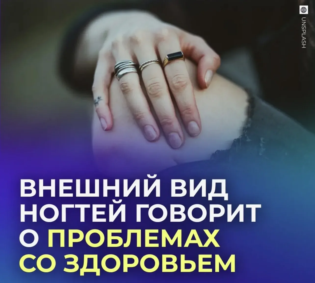 🔎 Внешний вид ногтей расскажет о проблемах со здоровьем.