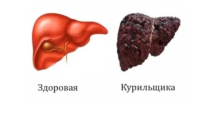 🌫 Врачи Хакасии: табачный дым вредит печени не меньше, чем лёгким
 
Связь между курением и болезням