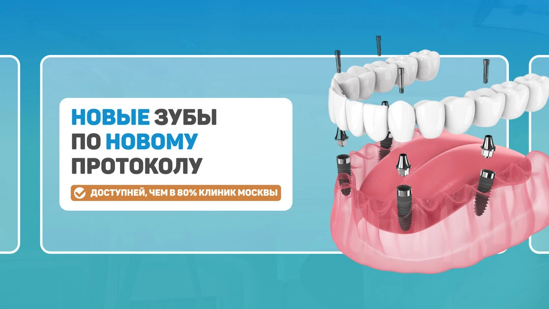Новые зубы сразу — без временных этапов!