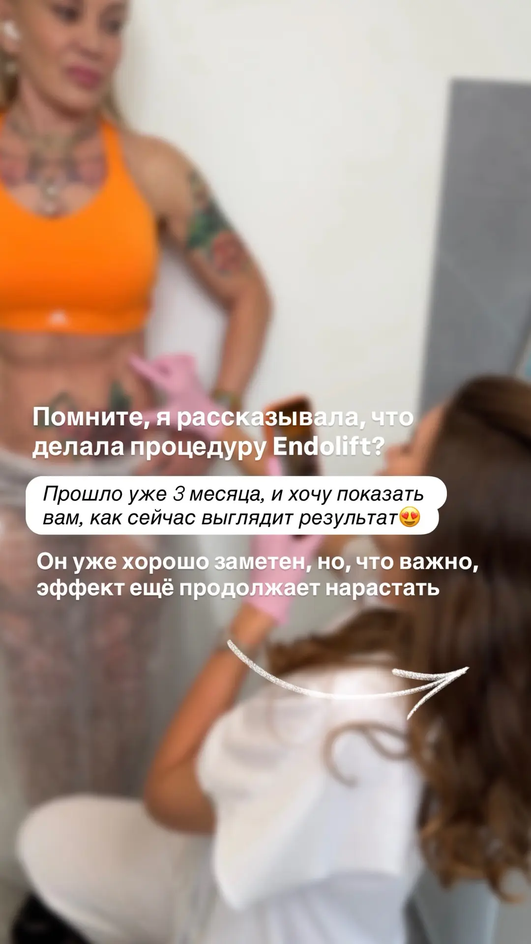 Спорт прекрасно работает с мышцами, но не способен сократить избыток кожи, про что я ва...