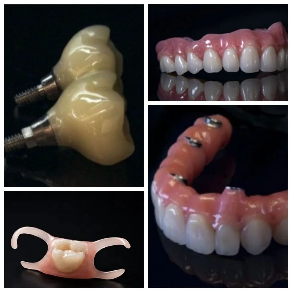 🦷 Какие зубные протезы бывают и какой выбрать?