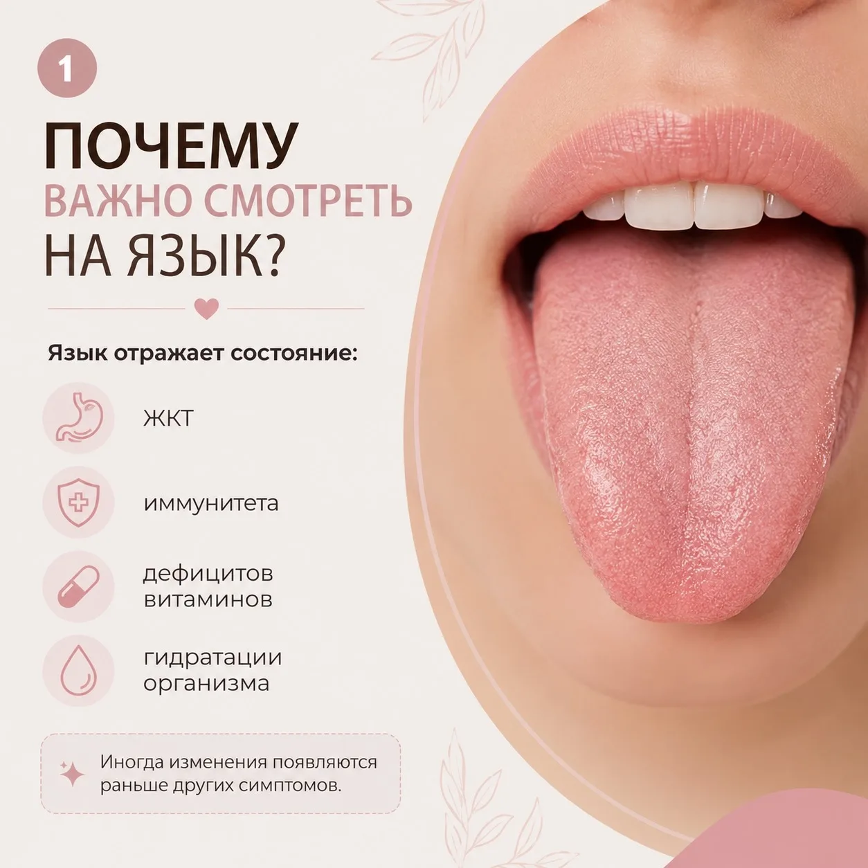 Язык как зеркало здоровья: что означают трещины, налёт и пятна? 👅

Иногда организм подаёт сигналы р