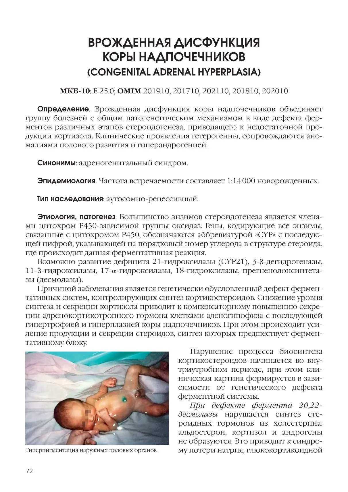 Врожденная дисфункция коры надпочечников