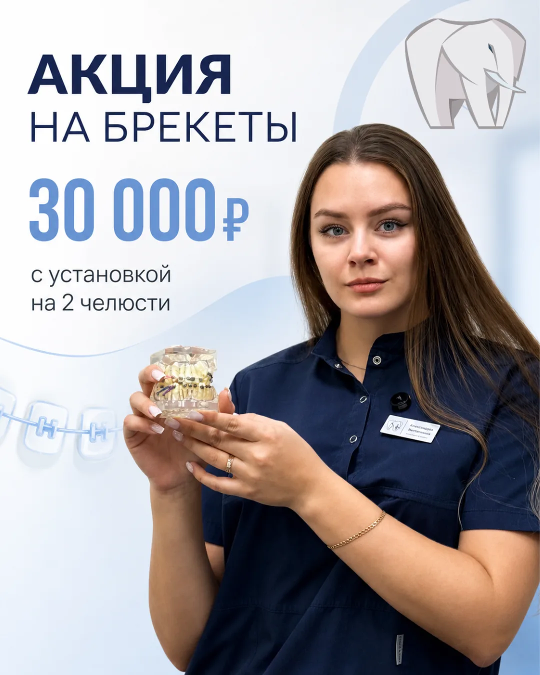 Акция на брекеты для всех до конца месяца. Стоимость с установкой на обе челюсти 30000 ...