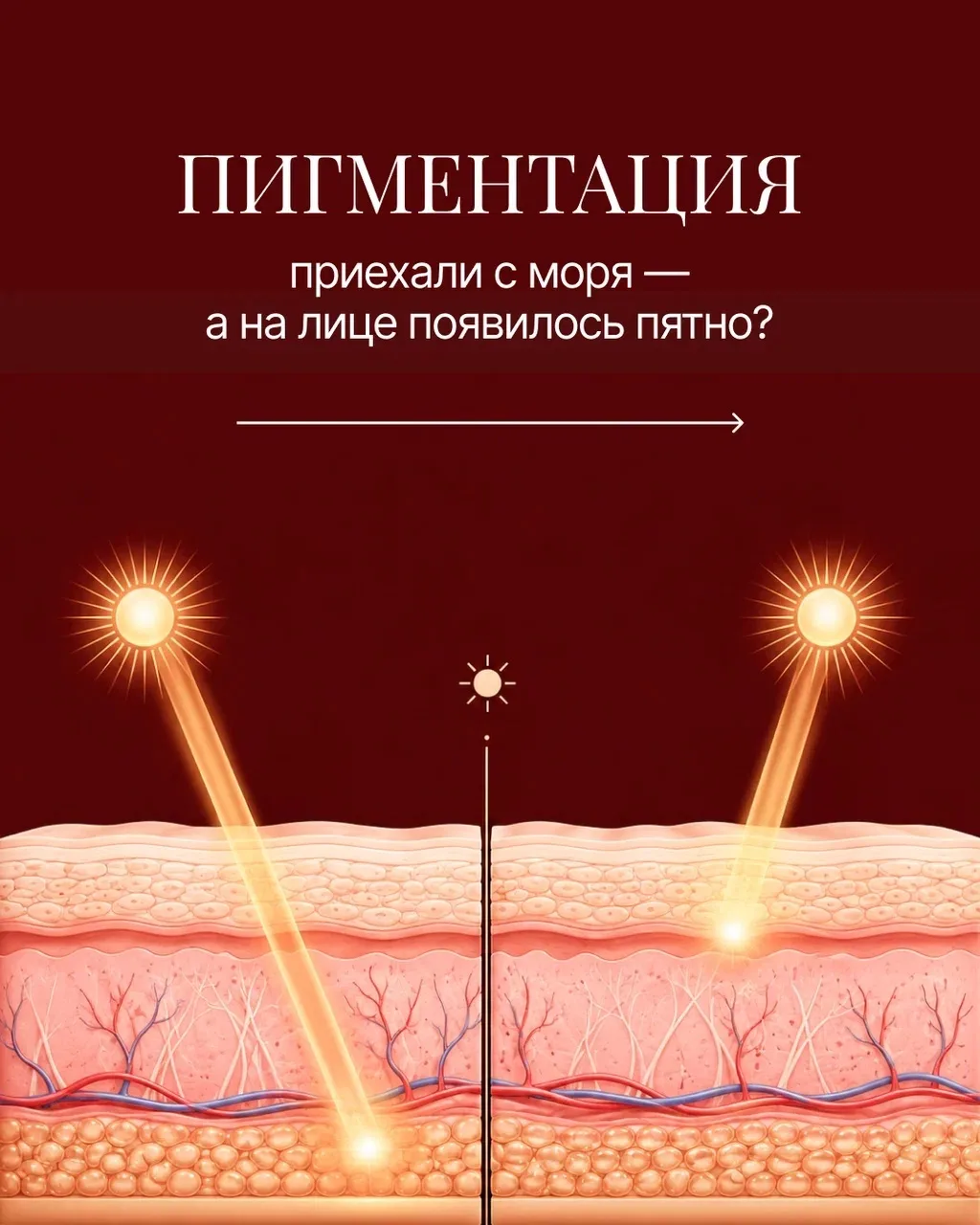 Думала, загар = красота, а получила пигментные пятна?