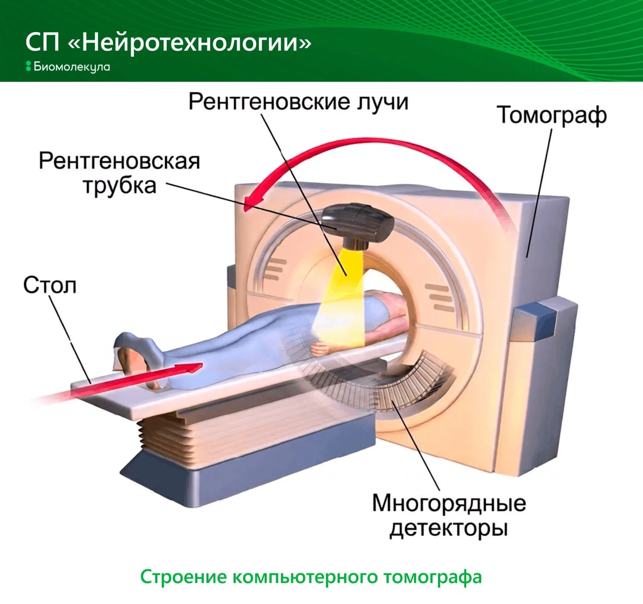 Сегодня компьютерная томография (КТ) — важнейший метод нейровизуализации. Внешне КТ-апп...