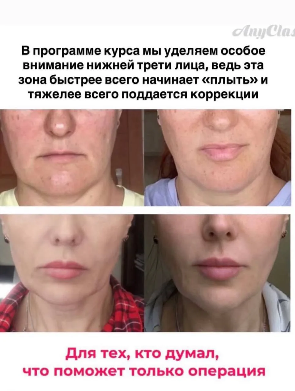 😳 Если вы прочитаете это, брыли могут появиться гораздо позже.