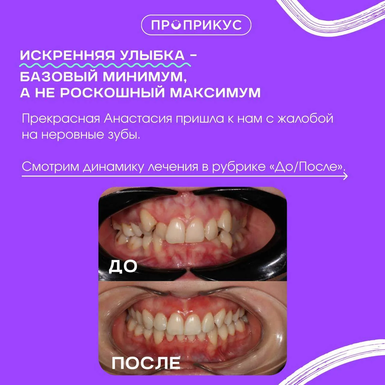 Рассказали про кейс Анастасии.