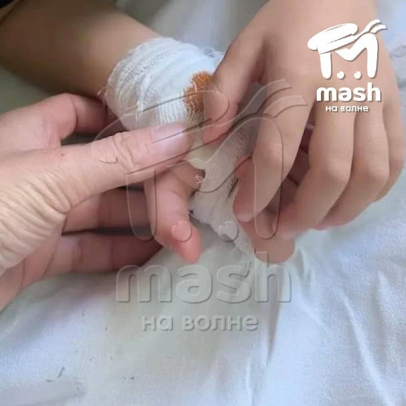 В Севастополе на детской площадке джек-рассел укусил трёхлетнего мальчика. Ребёнок гуля...