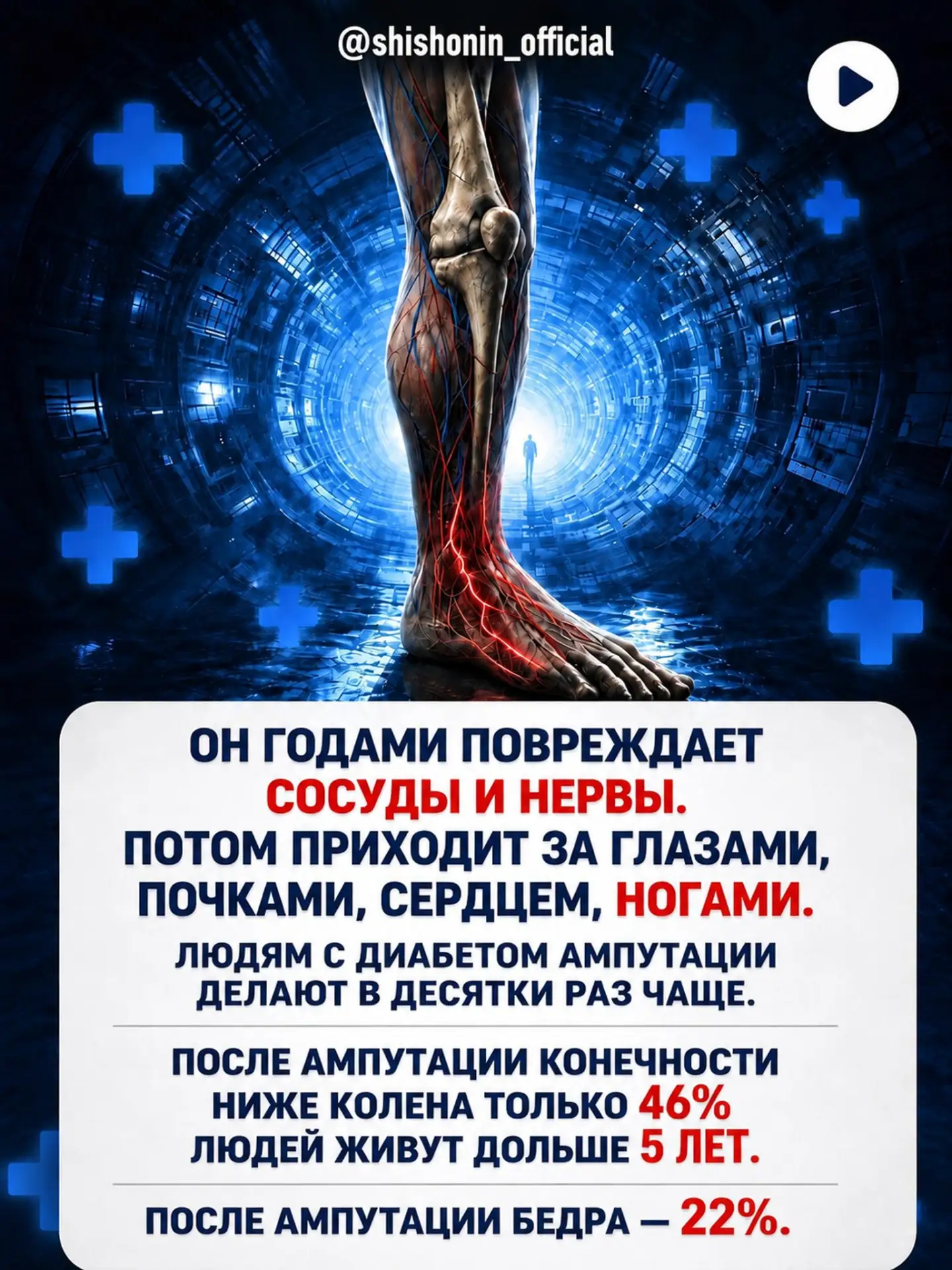 ℹ️  Высокий сахар — только верхушка айсберга. Что происходит при диабете 2-го типа на с...