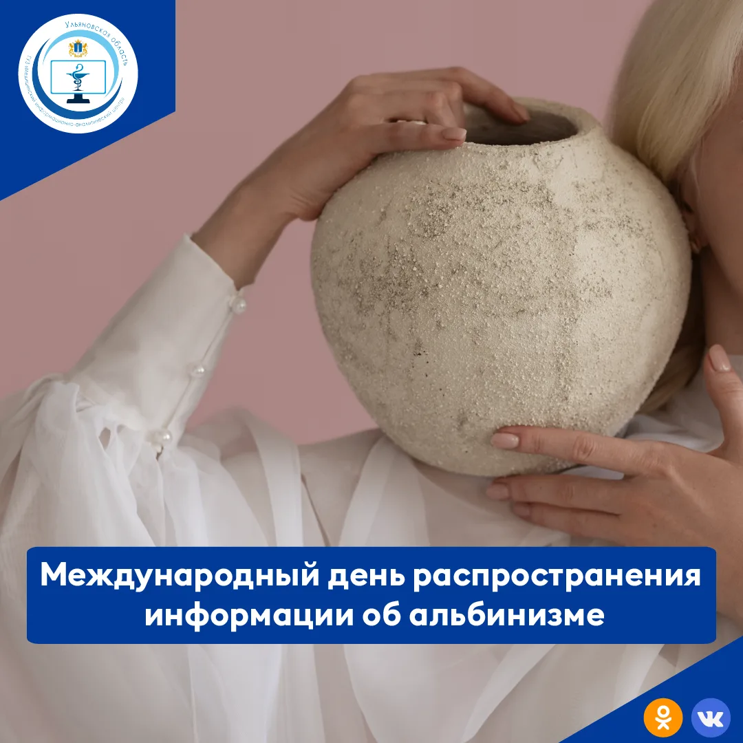 Сегодня, 13 июня жителей планеты призывают помнить, что все люди равны, даже очень непохожие на боль