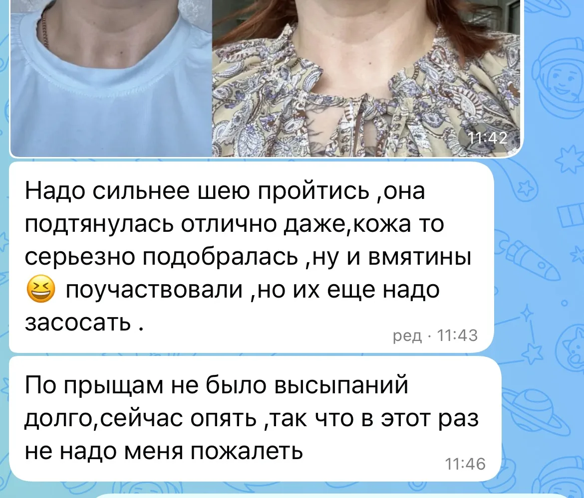 Еще один отзыв на игольчатый рф ❤️