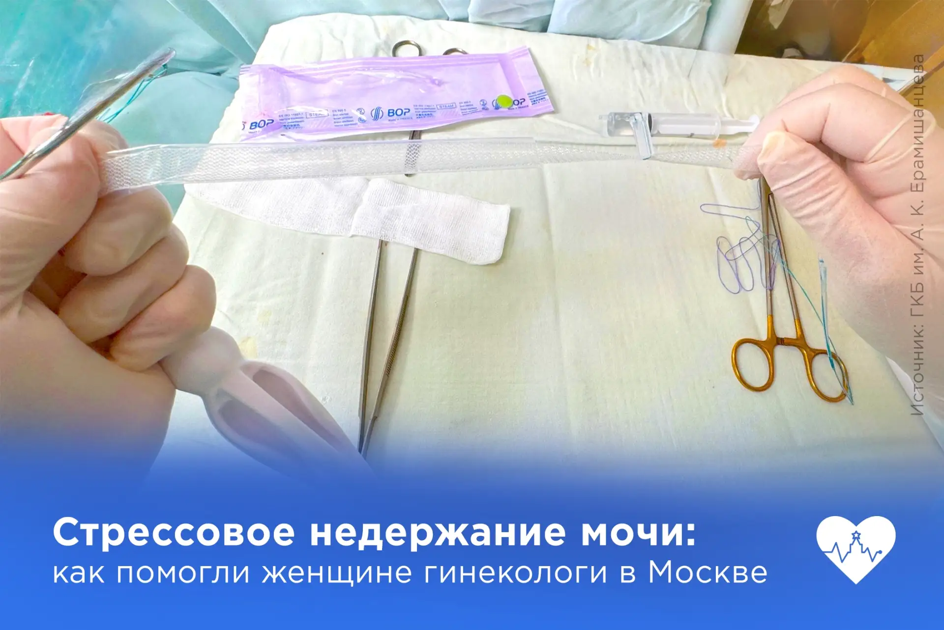 15 минут, и проблема решена: врачи избавили пациентку от недержания мочи

В гинекологическое отделен