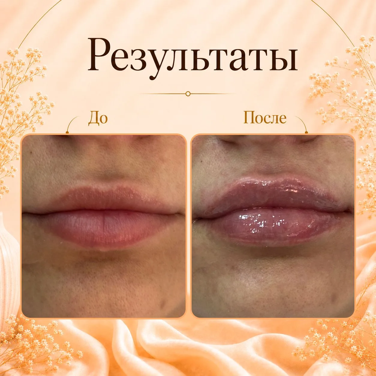 Чувственные и пухлые губы, о которых мечтает каждая💕