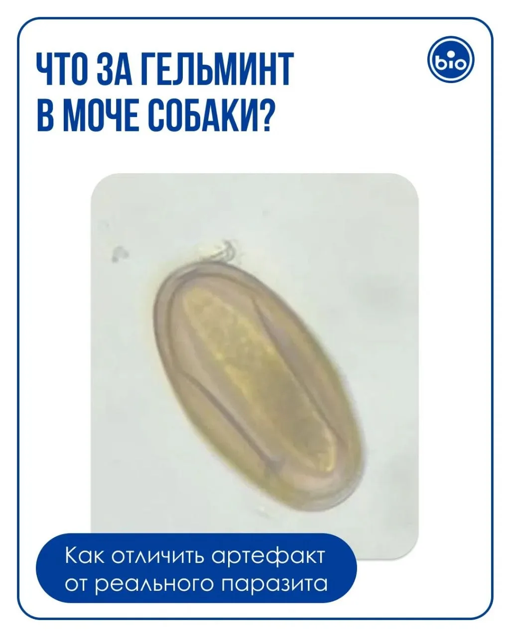 Что за гельминт в моче?
Ближе всего - к яйцам капилярии. Но тут нет крышечек.
На что еще можно подум