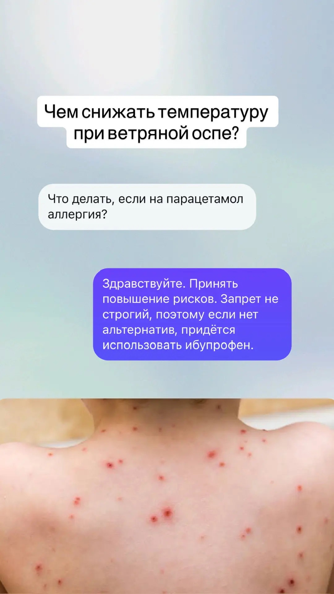 - чем снижать температуру при ветряной оспе, если аллергия на парацетамол - что делать, если произош