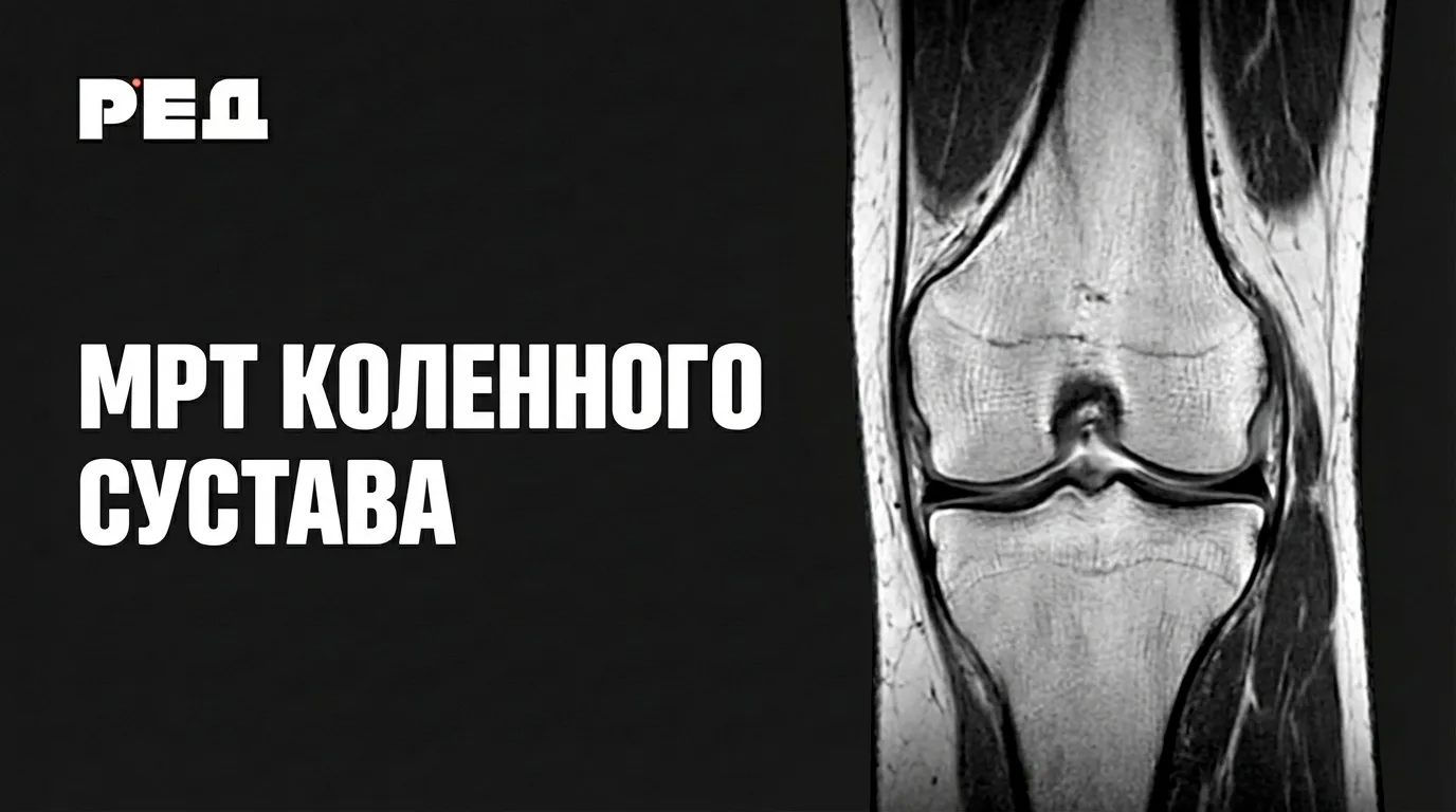 Коленный сустав – один из самых частых суставов на потоке. Но далеко не простой. Особен...