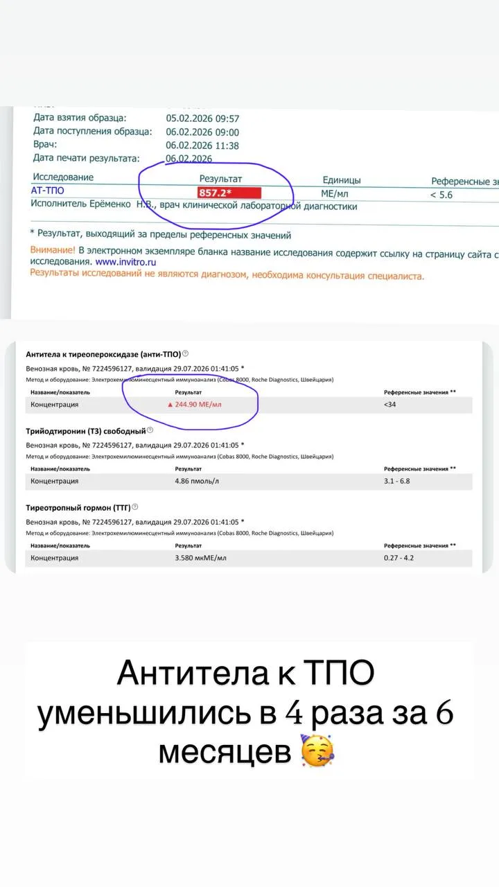 АУТОИММУННЫЙ ТИРЕОИДИТ, равно как и другие аутоиммунные заболевания больше НЕ ПРИГОВОР