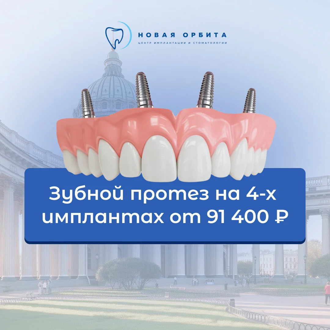 Центр имплантации и протезирования «Новая Орбита» в СПб!  Держим одни из лучших цен в Санкт-Петербур