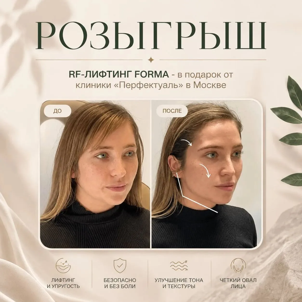 Дарим процедуру RF-лифтинга Forma одной из наших прекрасных подписчиц 🤍