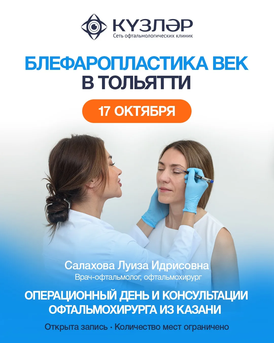 БЛЕФАРОПЛАСТИКА ВЕК В ТОЛЬЯТТИ