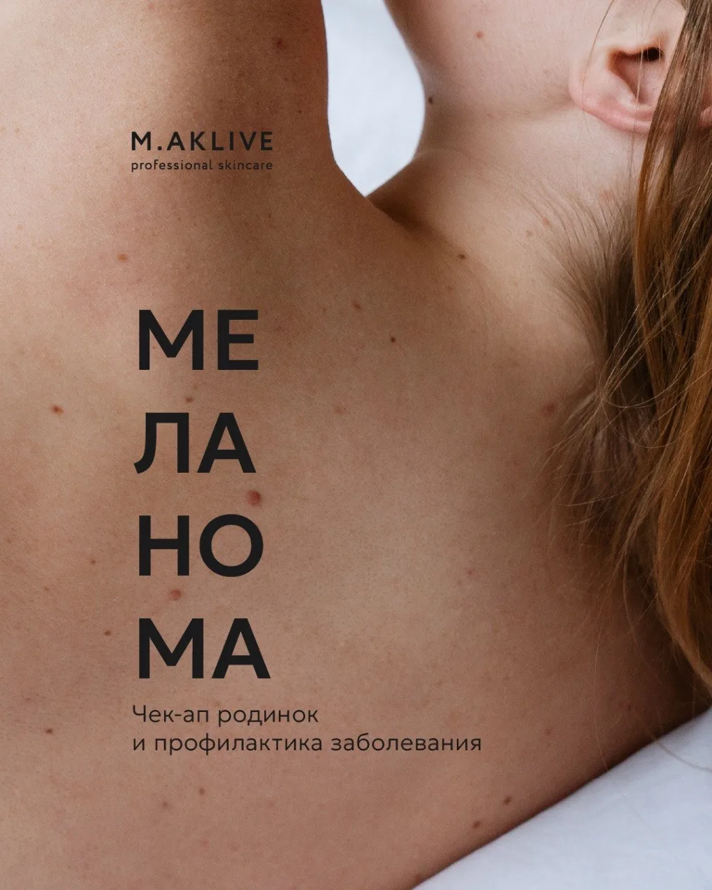 ✨Родинки есть у каждого из нас. Чаще всего они безобидны, но иногда требуют нашего вним...