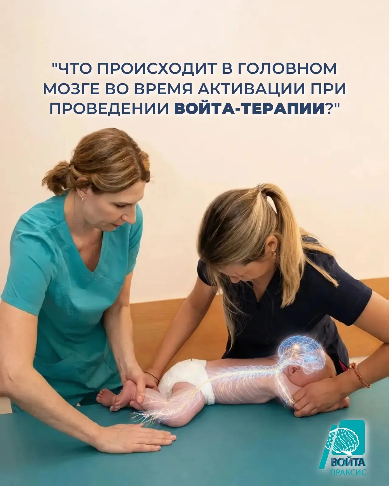 Что происходит в головном мозге во время активации при проведении Войта-терапии?