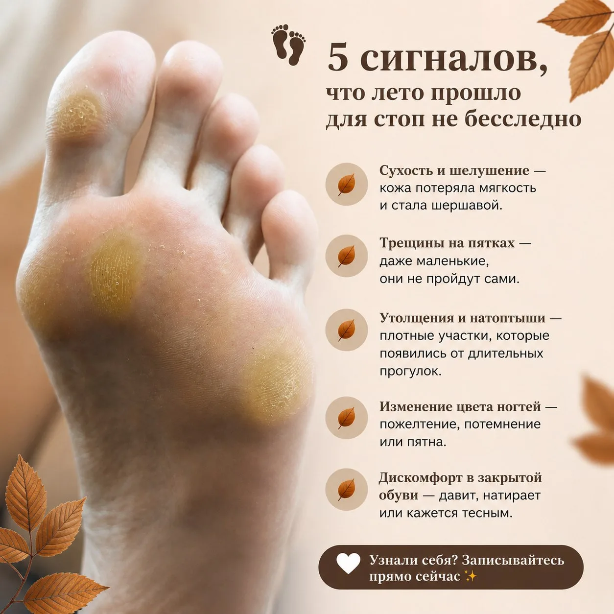 👣 5 сигналов, что лето прошло для стоп не бесследно