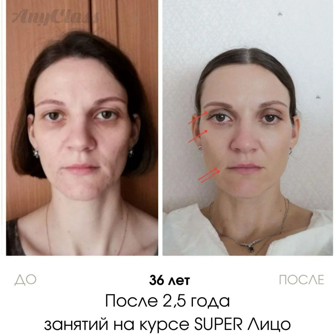 Из-за гимнастики появятся новые морщины👀  Это один из самых распространённых мифов о гимнастике, с к