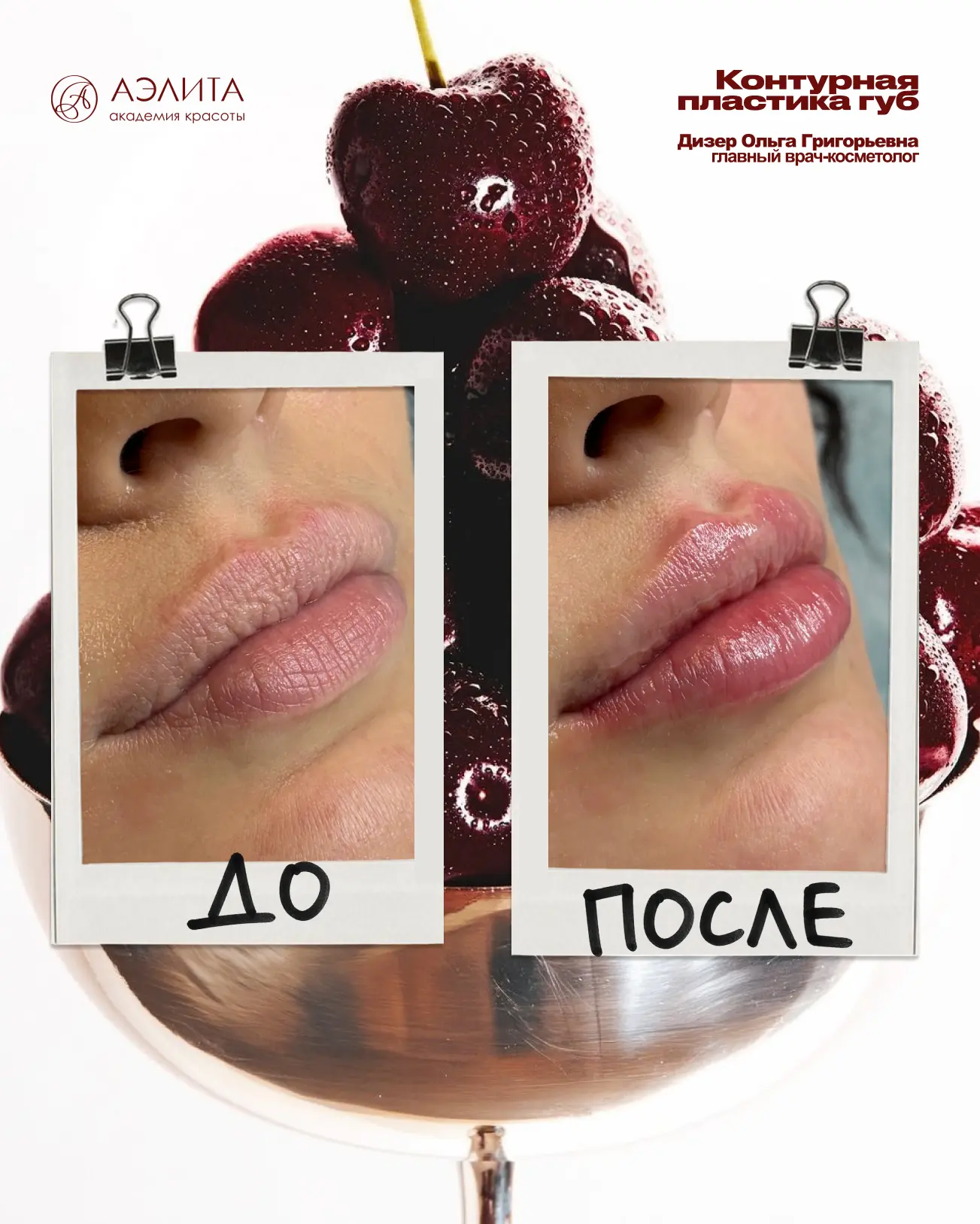 🍒 Аппетитные губы — хит летнего сезона!