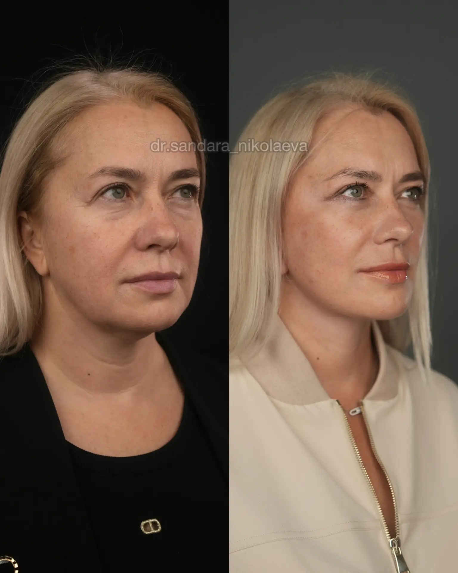 Изображение 4 к публикации «Пластический хирург Николаева Сандара Афанасьевна»