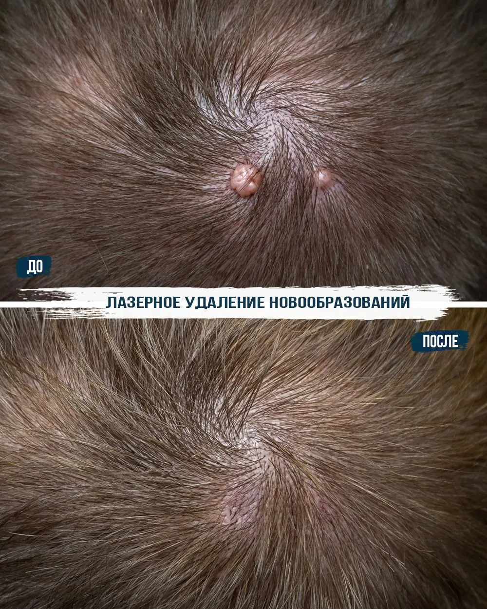 Постоянно задеваете расчёской или боитесь похода к парикмахеру? 💇‍♀️❌