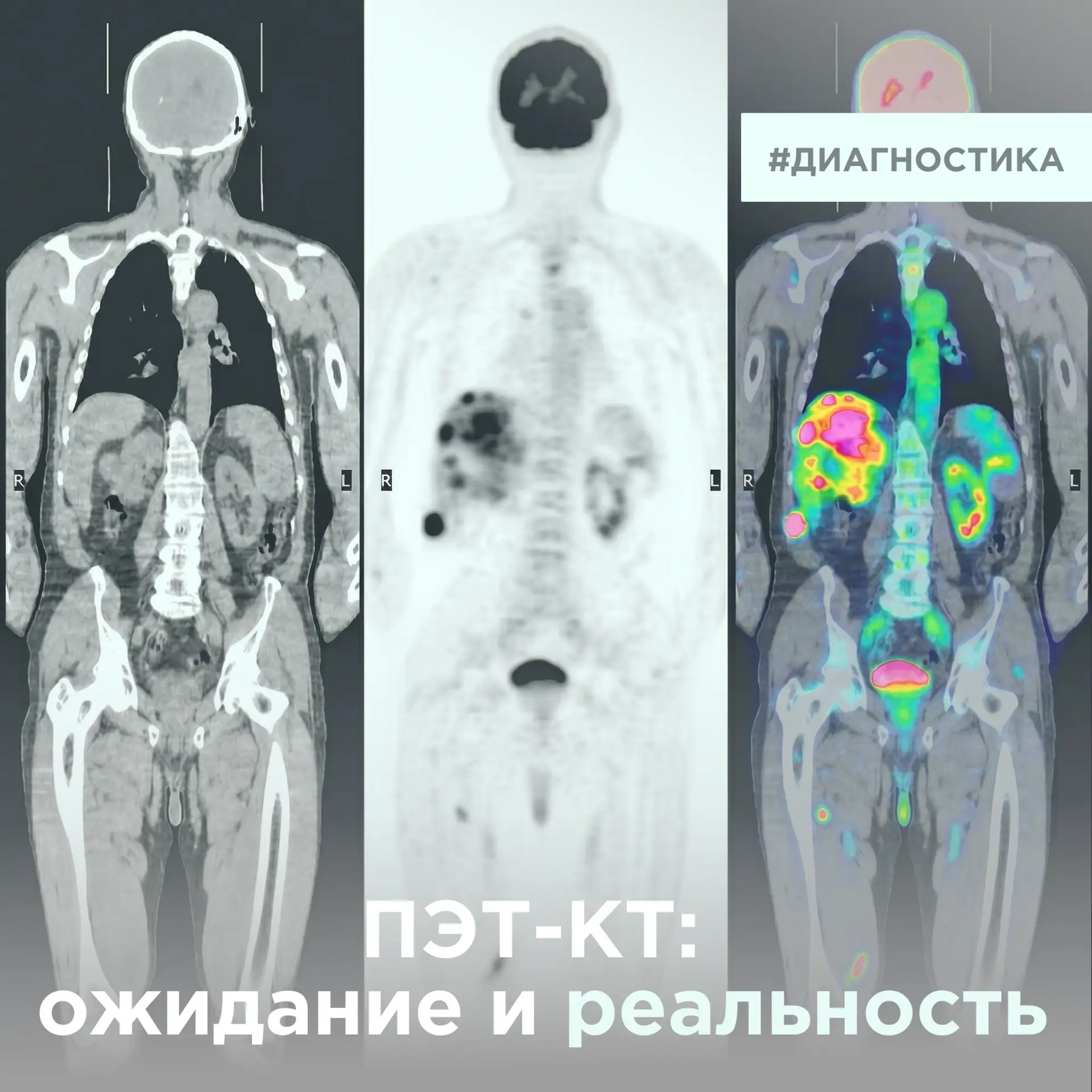 ПЭТ-КТ: ожидания vs реальность