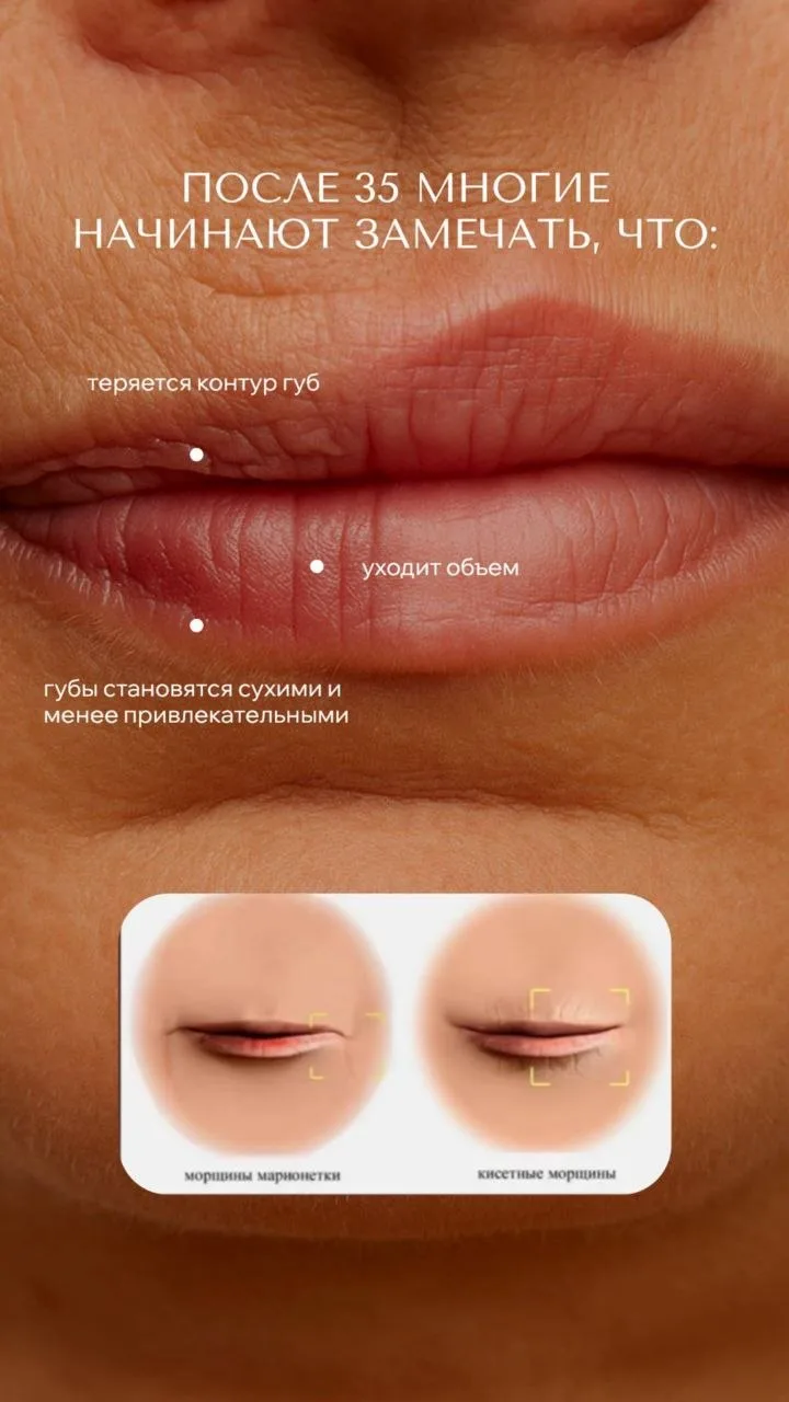 Почему губы стареют и что с этим делать? 💋