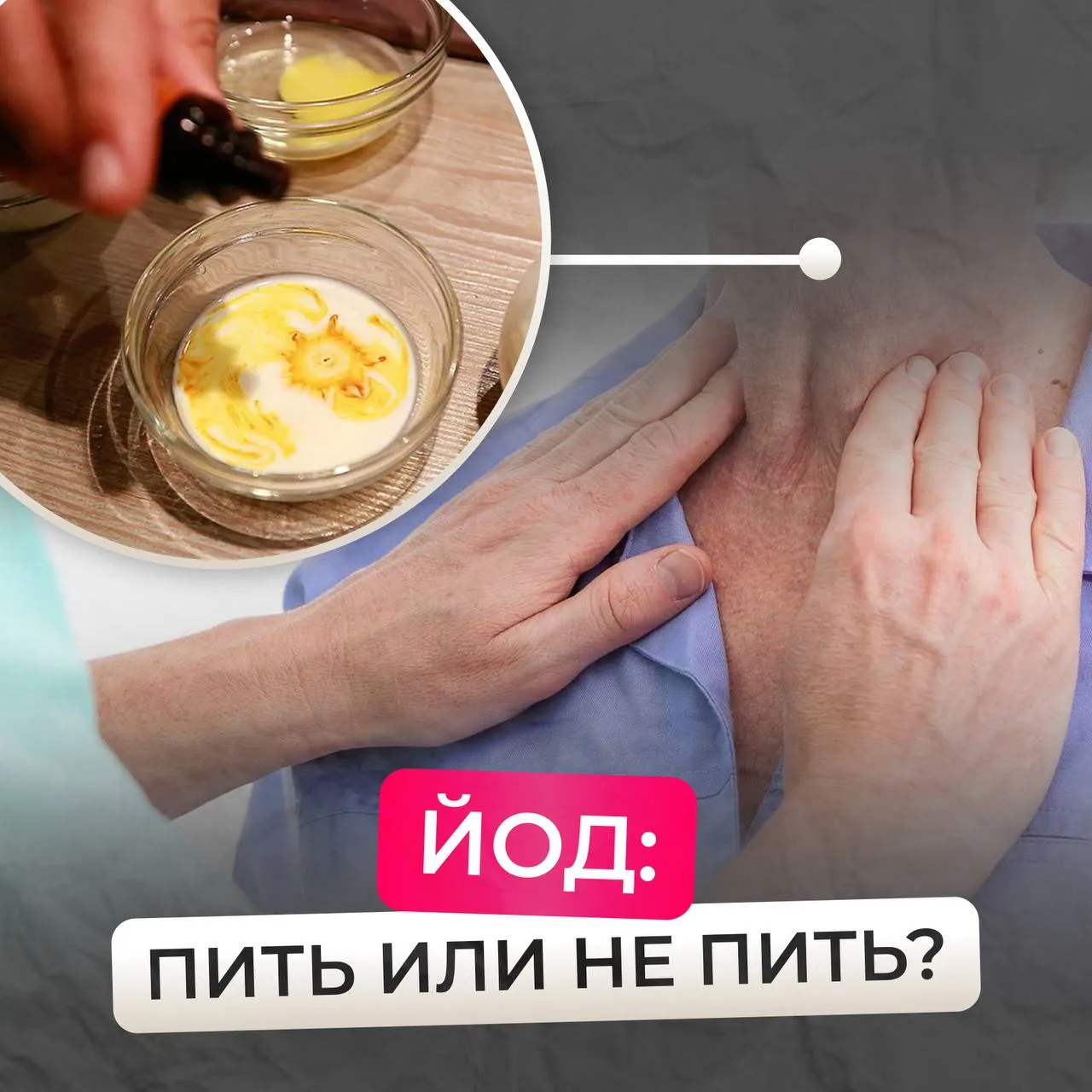 💚 ЙОД: когда пить, а когда — категорически нет  Каждая вторая женщина сталкивается с проблемами щито