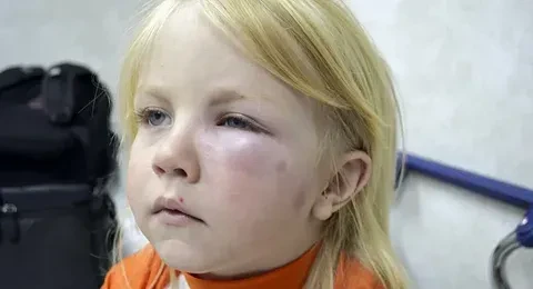 Уважаемые родители, здоровье каждого ребенка бесценно!