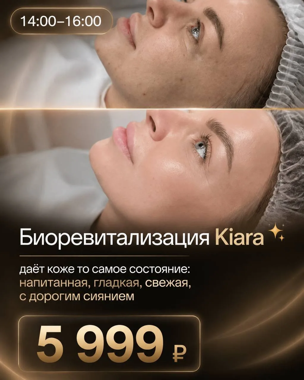 ✨ Биоревитализация Kiara PDRN

5️⃣9️⃣9️⃣9️⃣

💧 Лот для тех, кто хочет кожу с эффектом «выспалась, о
