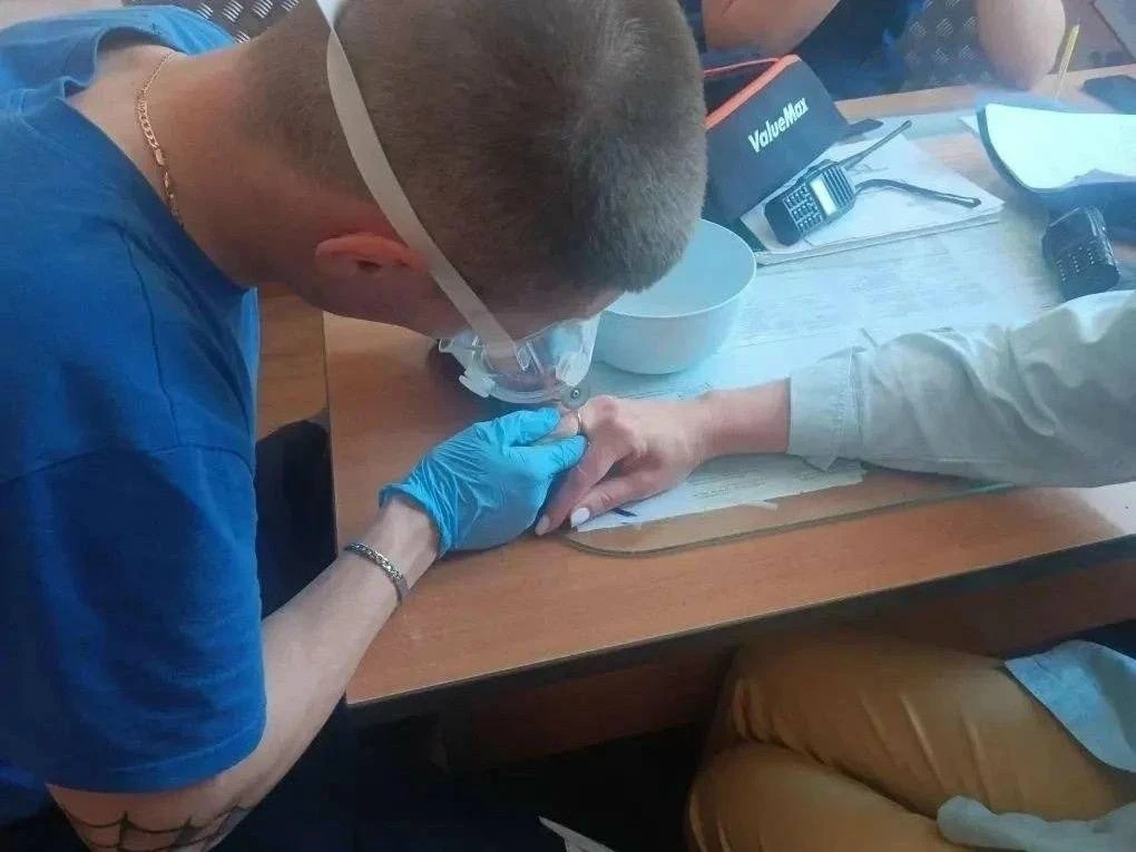В Башкортостане 37-летняя женщина не могла снять кольцо с пальца правой руки 
 
 Палец начал опухать