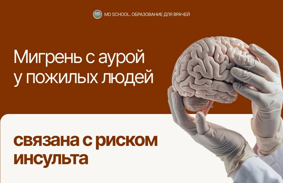 Мигрень с аурой у пожилых людей связана с риском инсульта 🧠

Связь между мигренью и ишемическим инс