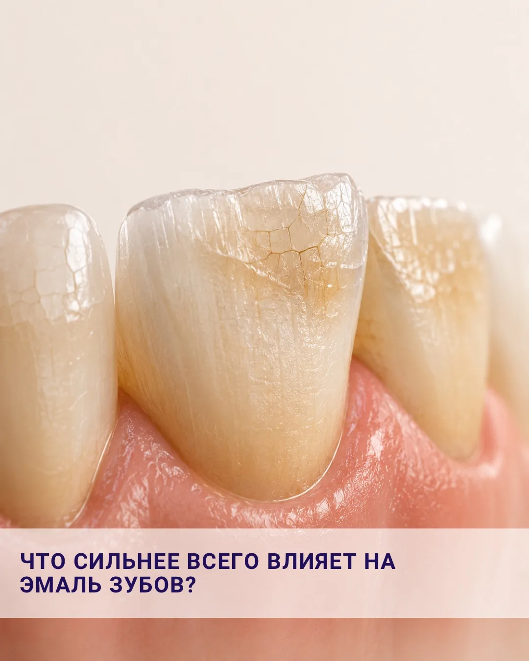 Что сильнее всего разрушает эмаль в повседневной жизни