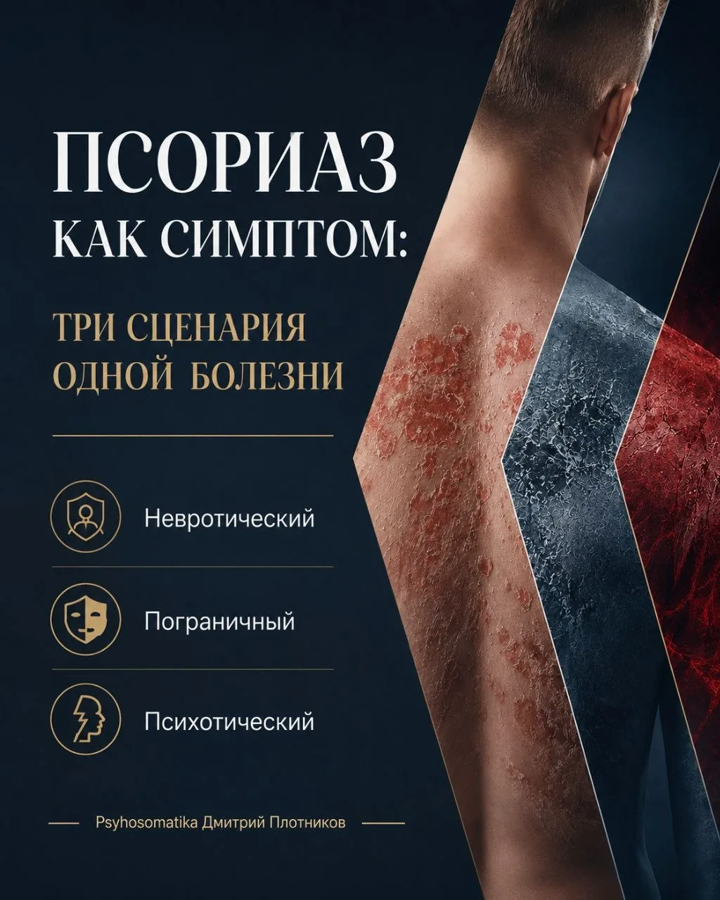 Почему у троих людей с псориазом могут быть три совершенно разные психологические истории?

Ошибка —