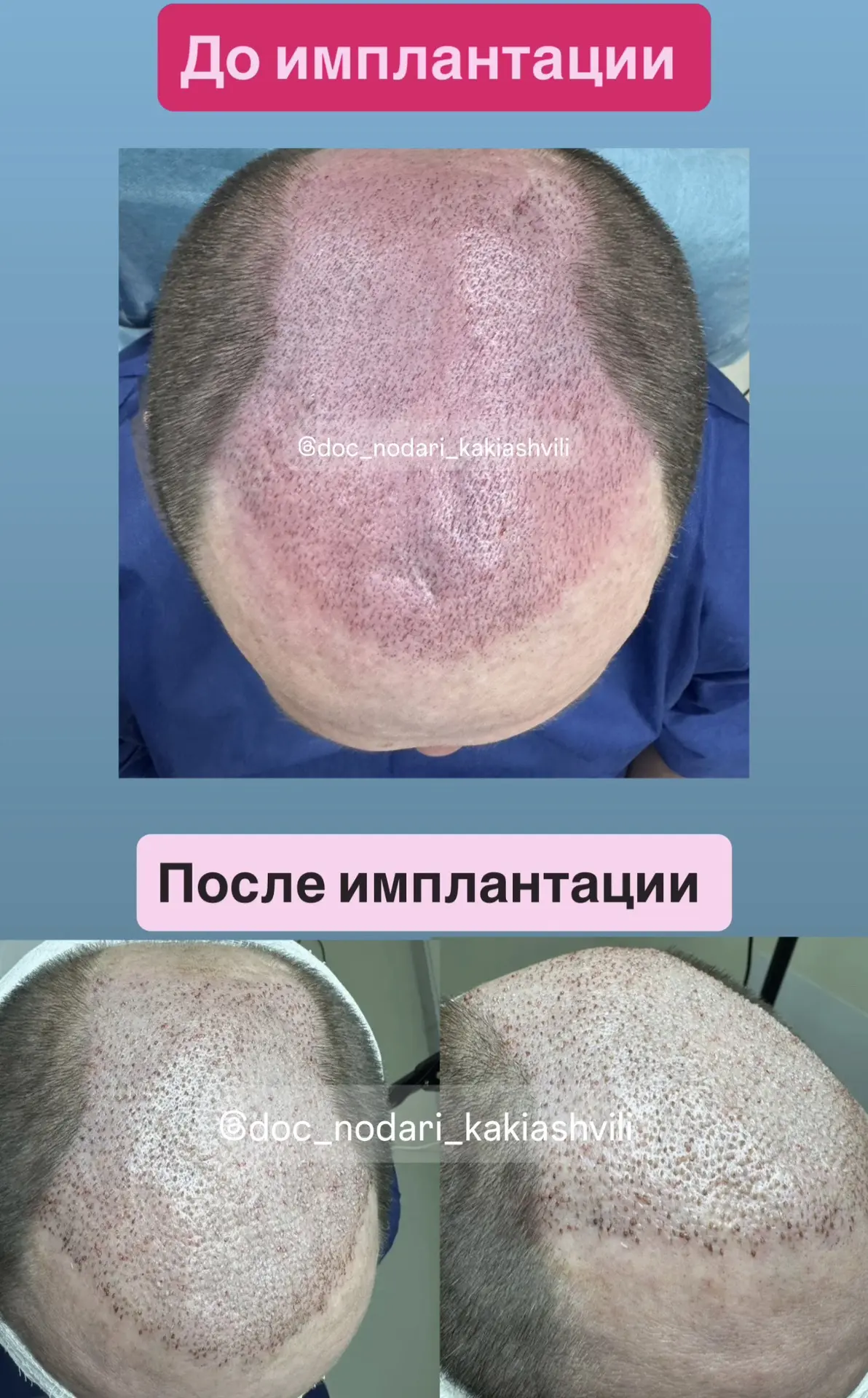 Полный отчет: более 9.000FU